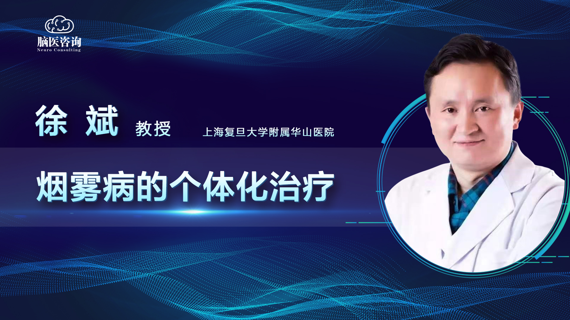脑医咨询患教直播课第十三期徐斌教授烟雾病的个体化治疗12月17日1930